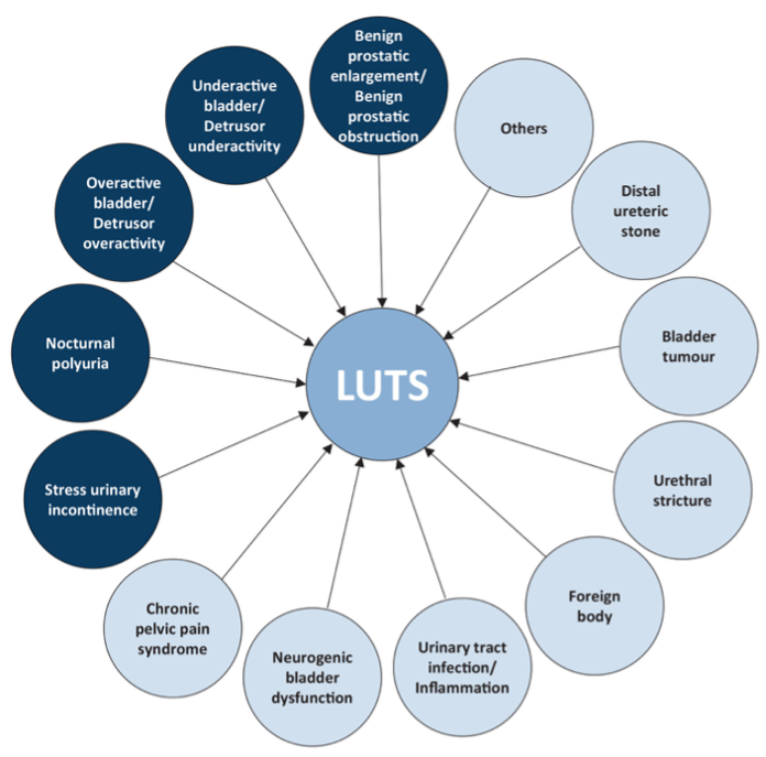 Possible urological causes for LUTS as per EAU guidelines